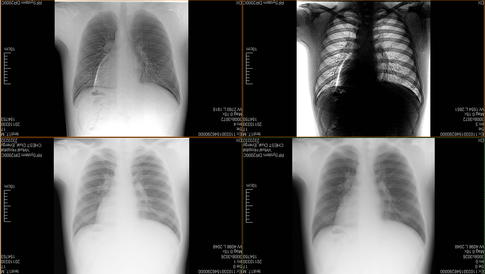 -DDR LINE - Direct Digital Radiology